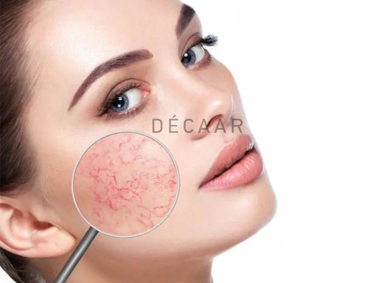 cách phục hồi da mỏng yếu tại nhà